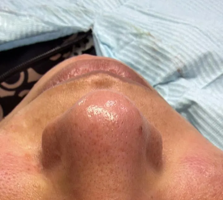 Case 02
