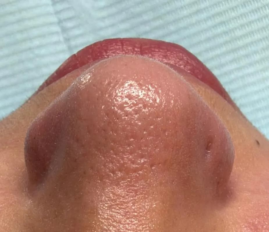 Case 03