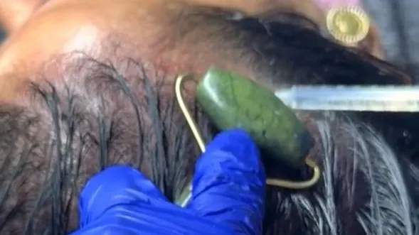 After Treatment