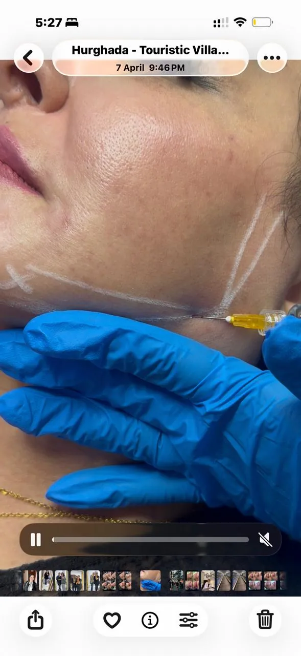 After Treatment