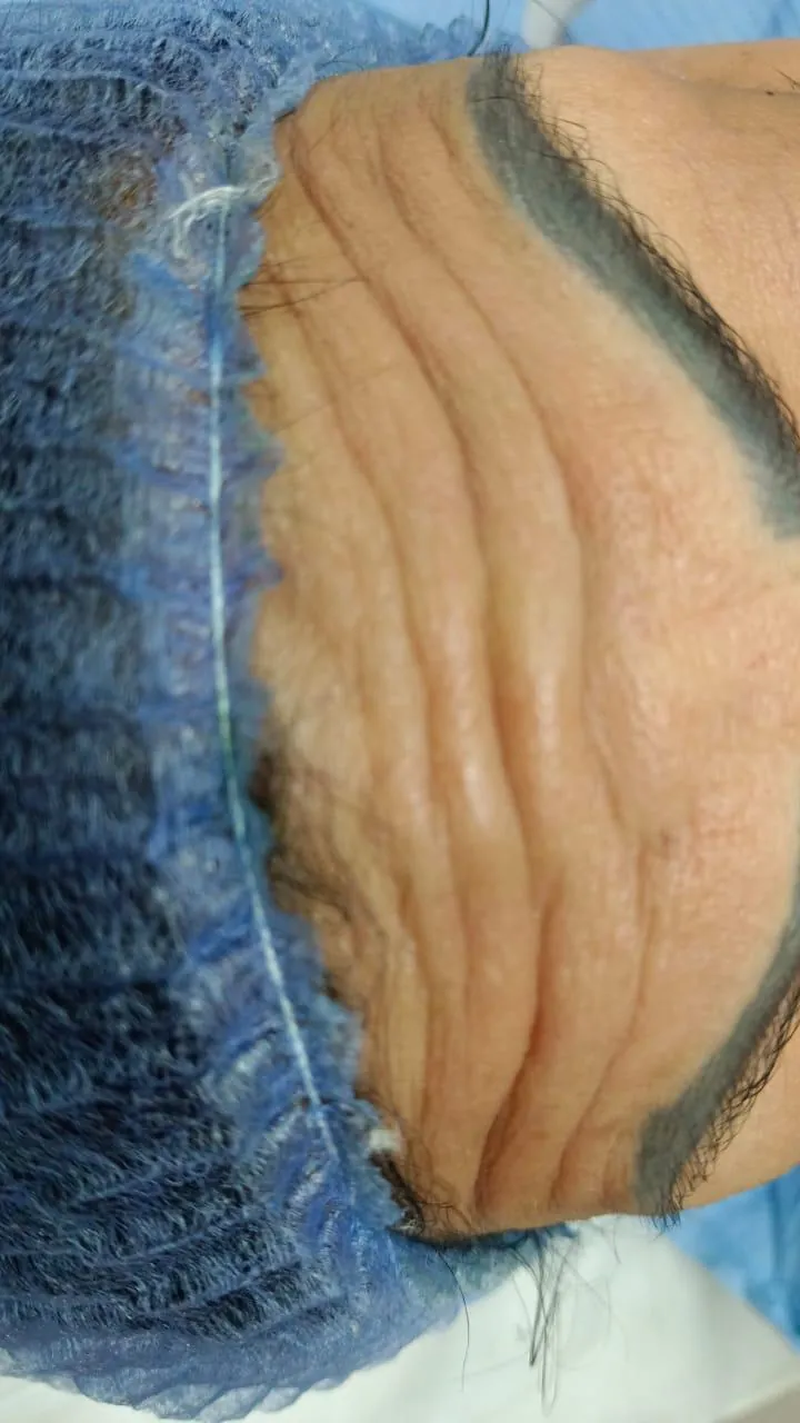 Thumbnail Before