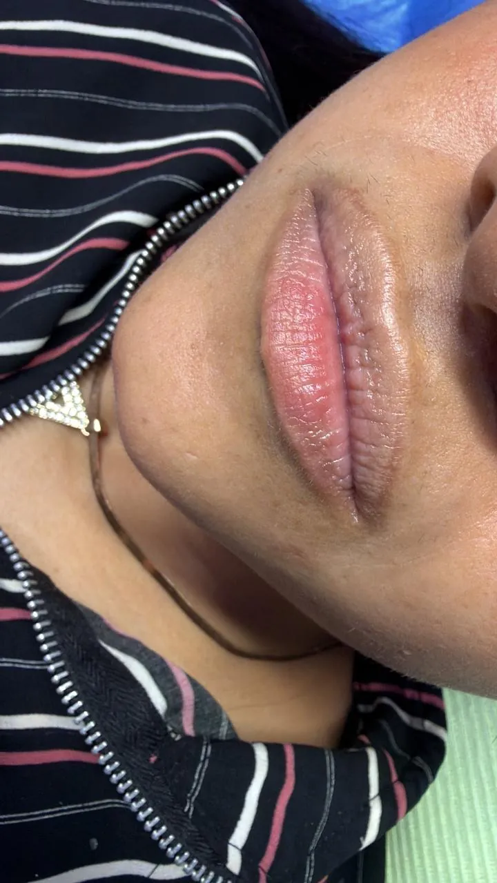 Thumbnail Before