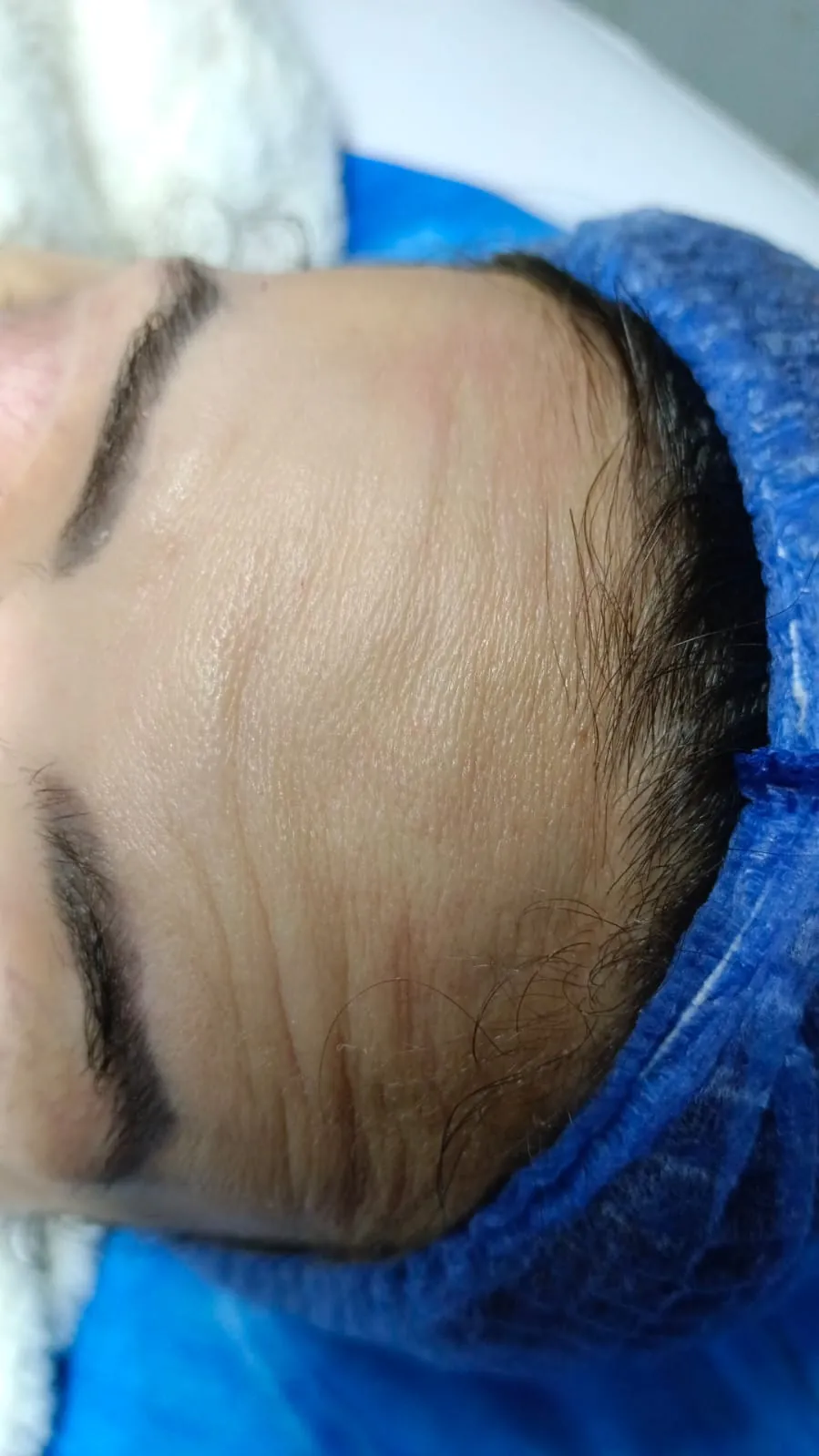 Thumbnail Before