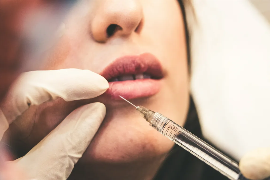 Dermal Filler Injections